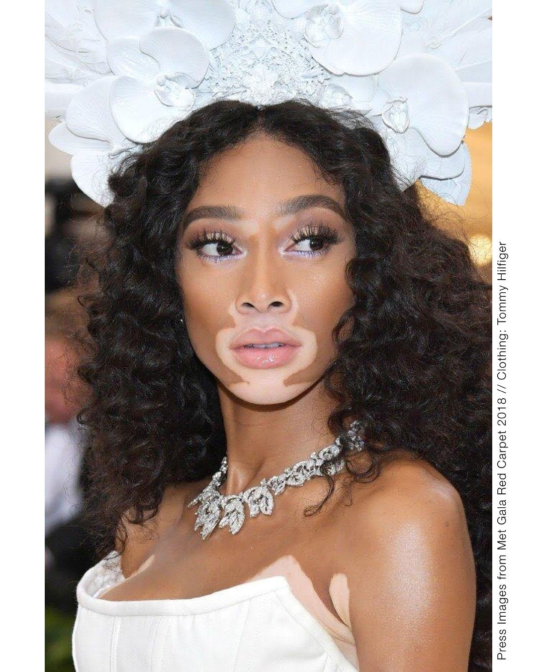 Winnie Harlow